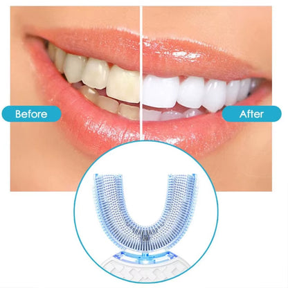 Intelligent Automatic U Type Modes Tooth Brush Sonic Electric Toothbrush USB Rechargeable Tooth Whitening Blue Light